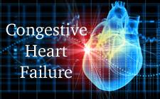 Congestive Heart Failure. What Is It? What Can We Do? - Mcleod Health