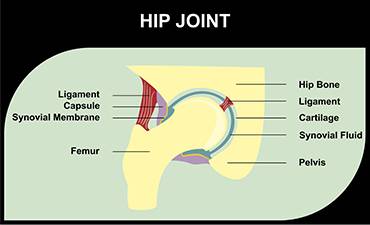 Total Hip Joint Replacement: The Basics You Need to Know - McLeod Health